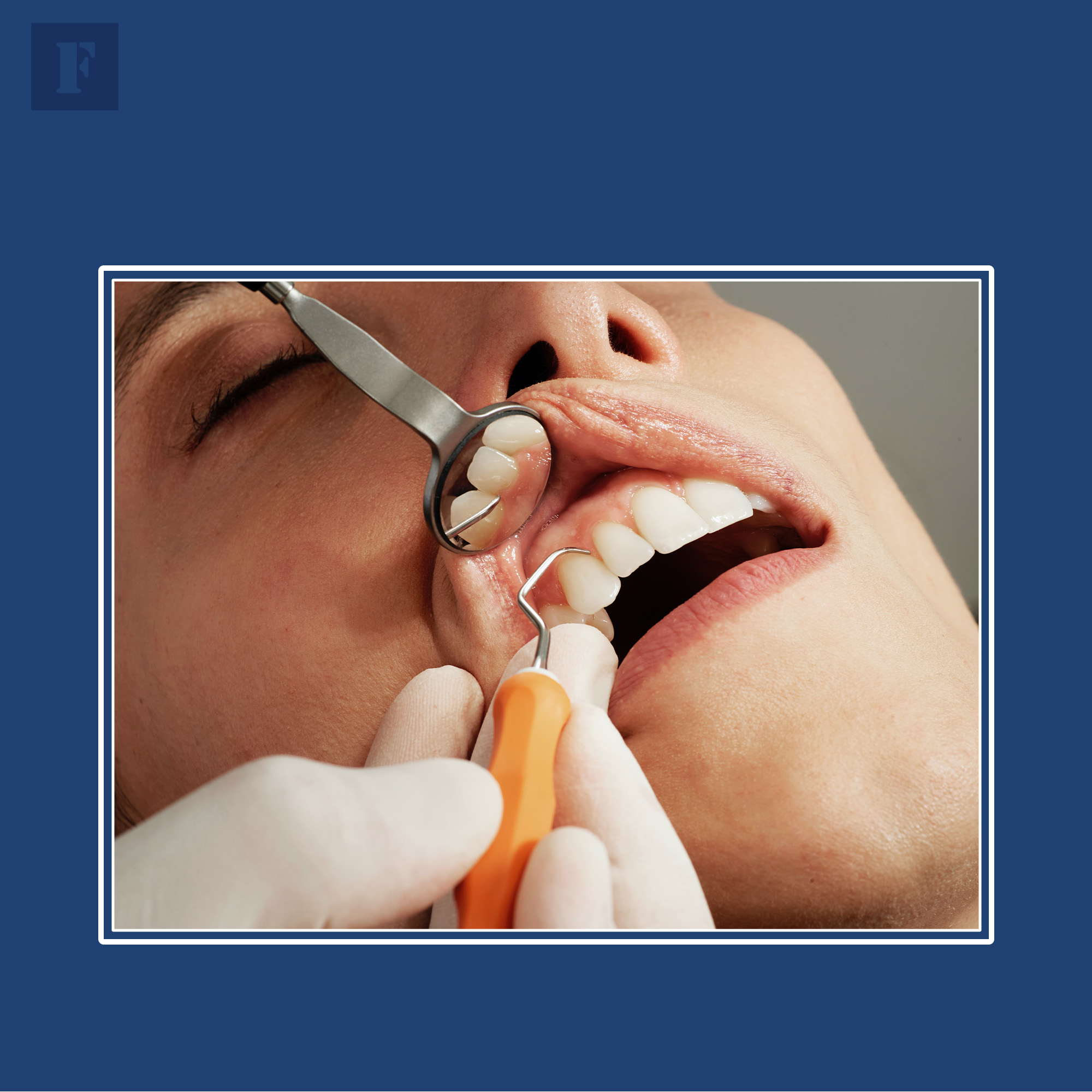 Дополнительное стоматологическое страхование Zahnzusatzversicherung