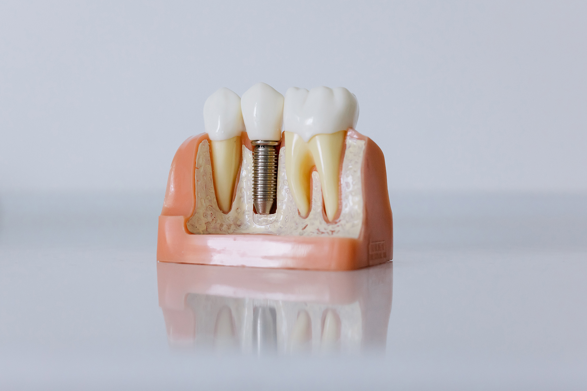 dental pic 1